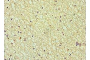 Immunohistochemistry of paraffin-embedded human brain tissue using ABIN7144027 at dilution of 1:100 (Amphiphysin antibody  (AA 340-620))