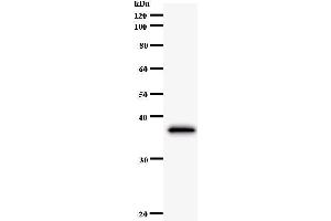 Western Blotting (WB) image for anti-Cbl Proto-Oncogene B, E3 Ubiquitin Protein Ligase (CBLB) antibody (ABIN933045) (Cbl Proto-Oncogene B, E3 Ubiquitin Protein Ligase (CBLB) antibody)