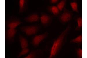 Immunofluorescence staining of methanol-fixed Hela cells using using Phospho-GATA1-S310 antibody. (GATA1 antibody  (pSer310))