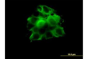 Immunofluorescence of monoclonal antibody to CCT2 on A-431 cell. (CCT2 antibody  (AA 117-217))