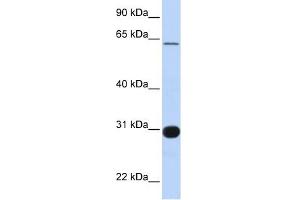 RALGPS1 antibody used at 1 ug/ml to detect target protein. (RALGPS1 antibody  (Middle Region))