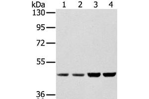 Western Blot analysis of Hela, Raji, 231 and K562 cell using SSB Polyclonal Antibody at dilution of 1:400 (SSB antibody)