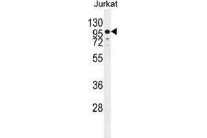 ZNF841 Antibody (N-term) western blot analysis in Jurkat cell line lysates (35 µg/lane). (ZNF841 antibody  (N-Term))