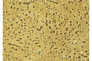 ABIN6275194 at 1/100 staining Mouse brain tissue by IHC-P. (Msx2/Hox8 antibody  (Internal Region))