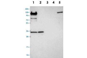 Western blot analysis of Lane 1: RT-4, Lane 2: U-251 MG, Lane 3: Human Plasma, Lane 4: Liver, Lane 5: Tonsil with RPL5 polyclonal antibody . (RPL5 antibody)