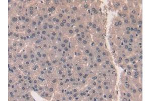 Used in DAB staining on fromalin fixed paraffin- embedded liver tissue (Midkine antibody  (AA 22-140))