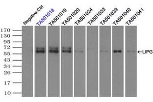 Image no. 8 for anti-Lipase, Endothelial (LIPG) antibody (ABIN1499165) (LIPG antibody)