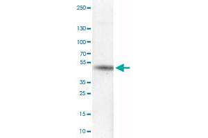 Western Blot analysis of RT-4 cell lysate with CA12 monoclonal antibody, clone CL0280 .