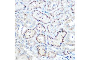 Immunohistochemistry (IHC) image for anti-Metalloproteinase Inhibitor 2 (TIMP2) (AA 100-200) antibody (ABIN1513608)