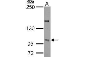 Western Blotting (WB) image for anti-Protein Phosphatase 4, Regulatory Subunit 4 (PPP4R4) (C-Term) antibody (ABIN1491842)