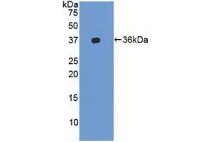 Detection of Recombinant LFA1a, Human using Polyclonal Antibody to Lymphocyte Function Associated Antigen 1 Alpha (CD11a) (ITGAL antibody  (AA 809-1066))