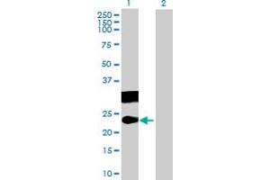 Western Blot analysis of CT45A3 expression in transfected 293T cell line by CT45A3 MaxPab polyclonal antibody. (CT45A3 antibody  (AA 1-189))