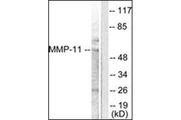 MMP11 antibody  (Internal Region)