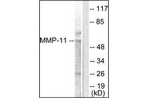 Western blot analysis of extracts from A549 cells, using MMP-11 Antibody. (MMP11 antibody  (Internal Region))