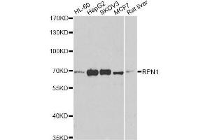 Western blot analysis of extracts of various cell lines, using RPN1 antibody. (RPN1 antibody  (AA 20-280))