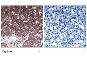 Image no. 1 for anti-Insulin-Like Growth Factor 1 Receptor (IGF1R) (Tyr1280) antibody (ABIN197576) (IGF1R antibody  (Tyr1280))