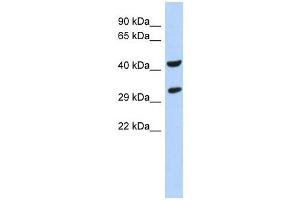 Western Blotting (WB) image for anti-Ankyrin Repeat and SOCS Box Containing 8 (ASB8) (N-Term) antibody (ABIN634410) (ASB8 antibody  (N-Term))