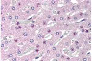 Human Liver (formalin-fixed, paraffin-embedded) stained with C14orf68 antibody ABIN298066 at 2. (SLC25A47 antibody  (AA 242-254))