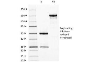 SDS-PAGE Analysis of Purified, BSA-Free Fascin Antibody (clone FSCN1/417). (Fascin antibody)