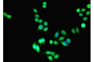 Immunofluorescent analysis of PC-3 cells using ABIN7158230 at dilution of 1:100 and Alexa Fluor 488-congugated AffiniPure Goat Anti-Rabbit IgG(H+L) (DLEU1 antibody  (AA 1-78))