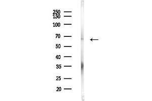 Western blot analysis of lysates from Hela cells(heat-shock,45 min treatment), using LK Antibody at 1/1000 dilution.