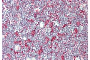 Rabbit Anti-SMPD3 antibody  Formalin Fixed Paraffin Embedded Tissue: Human Thymus Primary antibody Concentration: 1:100 Secondary Antibody: Donkey anti-Rabbit-Cy3 Secondary Antibody Concentration: 1:200 Magnification: 20x Exposure Time: 0. (SMPD3 antibody  (Middle Region))