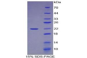 SDS-PAGE (SDS) image for Activating Transcription Factor 4 (Tax-Responsive Enhancer Element B67) (ATF4) (AA 126-291) protein (His tag) (ABIN2123902)