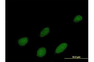 Immunofluorescence of purified MaxPab antibody to IPMK on HeLa cell. (IPMK antibody  (AA 1-416))