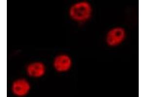 ABIN6275311 staining HepG2 by IF/ICC. (NLE1 antibody  (Internal Region))
