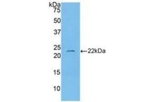 WB of Protein Standard: different control antibodies against Highly purified E. (IL-1 beta ELISA Kit)