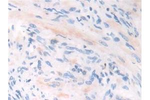 Immunohistochemistry (IHC) image for anti-Interferon, gamma-Inducible Protein 30 (IFI30) (AA 1-250) antibody (ABIN7435856)