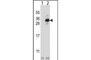 Western blot analysis of CLTB (arrow) using rabbit polyclonal CLTB Antibody (ABIN656850 and ABIN2846055). (CLTB antibody)