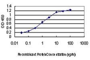 Detection limit for recombinant GST tagged LIMK1 is approximately 0. (LIM Domain Kinase 1 antibody  (AA 548-647))
