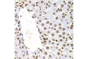 Immunohistochemistry (Paraffin-embedded Sections) (IHC (p)) image for anti-Nuclear Factor of kappa Light Polypeptide Gene Enhancer in B-Cells 2 (NFKB2) (AA 690-899) antibody (ABIN3017388)