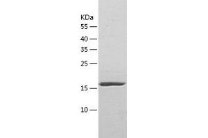 Western Blotting (WB) image for RAB10, Member RAS Oncogene Family (RAB10) (AA 1-200) protein (His tag) (ABIN7286624) (RAB10 Protein (AA 1-200) (His tag))