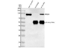 Immunoprecipitating (IP) PROX1 in SH-SY5Y whole cell lysate.