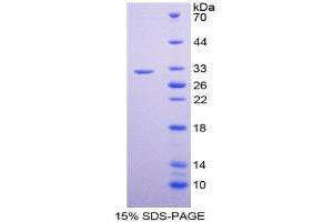 SDS-PAGE (SDS) image for GATA Binding Protein 1 (Globin Transcription Factor 1) (GATA1) (AA 42-292) protein (His tag) (ABIN2124932)