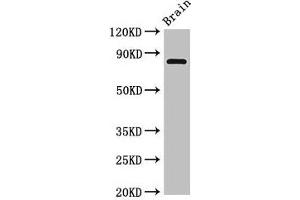 Western Blot Positive WB detected in: Rat brain tissue All lanes: Loxl4 antibody at 4 μg/mL Secondary Goat polyclonal to rabbit IgG at 1/50000 dilution Predicted band size: 85 kDa Observed band size: 85 kDa (LOXL4 antibody  (AA 26-757))