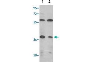 Western blot analysis of IDH3A polyclonal antibody  in (1) MCF-7, (2) Jurkat cell line lysates (35ug/lane). (IDH3A antibody  (C-Term))