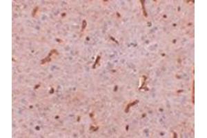 Immunohistochemistry of TWA1 in rat brain tissue with this product at 2. (TTC5 antibody  (C-Term))