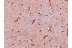 Immunohistochemistry of TWA1 in rat brain tissue with this product at 2. (TTC5 antibody  (C-Term))