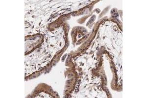 Immunohistochemical staining of human placenta with CXorf15 polyclonal antibody  shows cytoplasmic positivity in trophoblastic cells at 1:1000-1:2500 dilution. (Taxilin gamma (TXLNG) (AA 408-522) antibody)