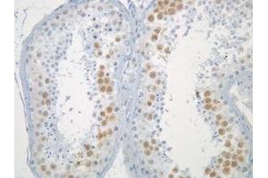 Immunohistochemistry of normal testis (formalin fixed) after antigen retreival, stained with Anti-Mad2L1 (clone 17D10)). (MAD2L1 antibody)