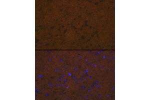 Immunofluorescence (IF) image for anti-Talin 2 (TLN2) antibody (ABIN7270720)