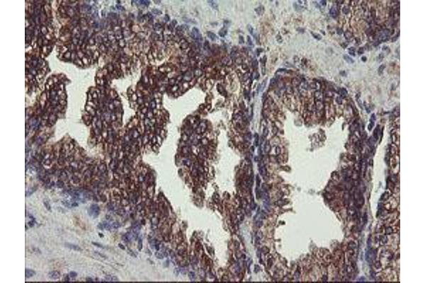 UBE2J1 antibody