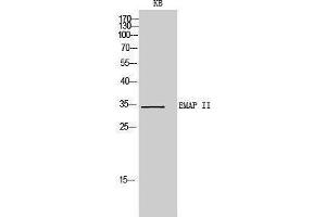 Western Blotting (WB) image for anti-Aminoacyl tRNA Synthetase Complex-Interacting Multifunctional Protein 1 (AIMP1) (Internal Region) antibody (ABIN6285385)