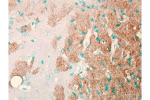 Immunohistochemistry analysis using Mouse Anti-Nav1. (SCN9A antibody  (AA 1751-1946) (PerCP))
