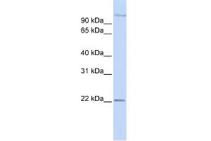 WB Suggested Anti-PDS5B Antibody Titration: 0. (PDS5B antibody  (Middle Region))