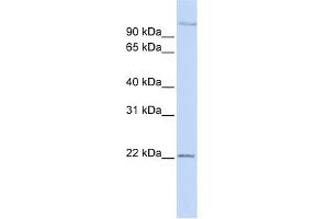 WB Suggested Anti-PDS5B Antibody Titration: 0.