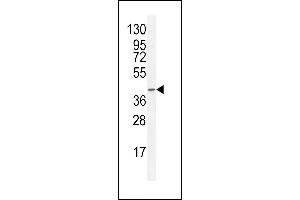 F8A2 Antibody (N-term) (ABIN655340 and ABIN2844904) western blot analysis in CEM cell line lysates (35 μg/lane). (F8A2 antibody  (N-Term))